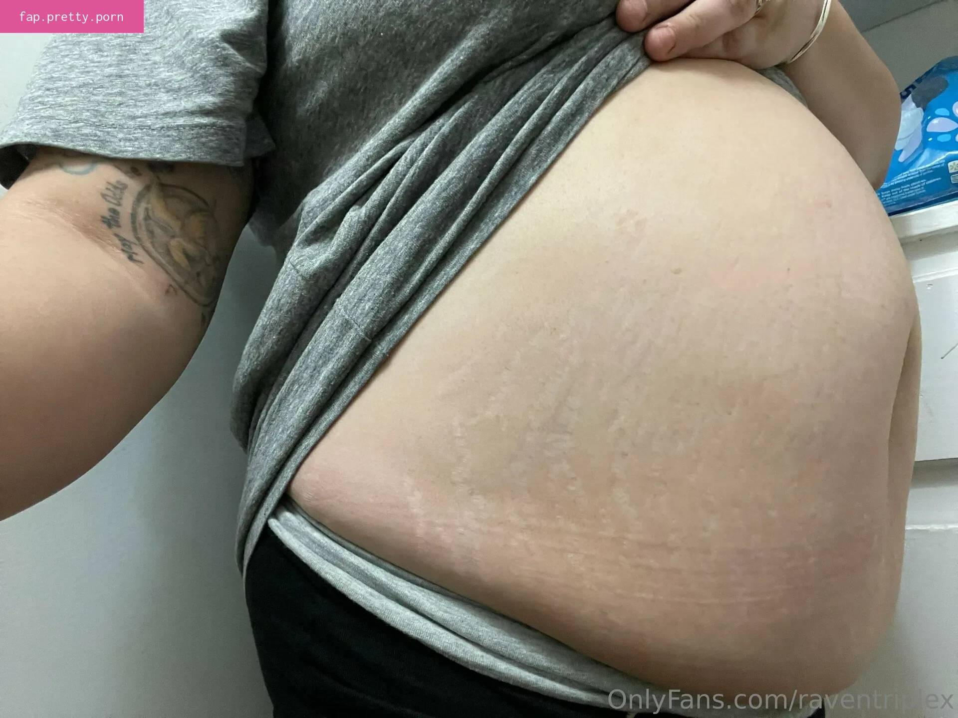 raventriplex - Photo #92