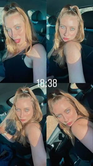 Shachar Alkoser content